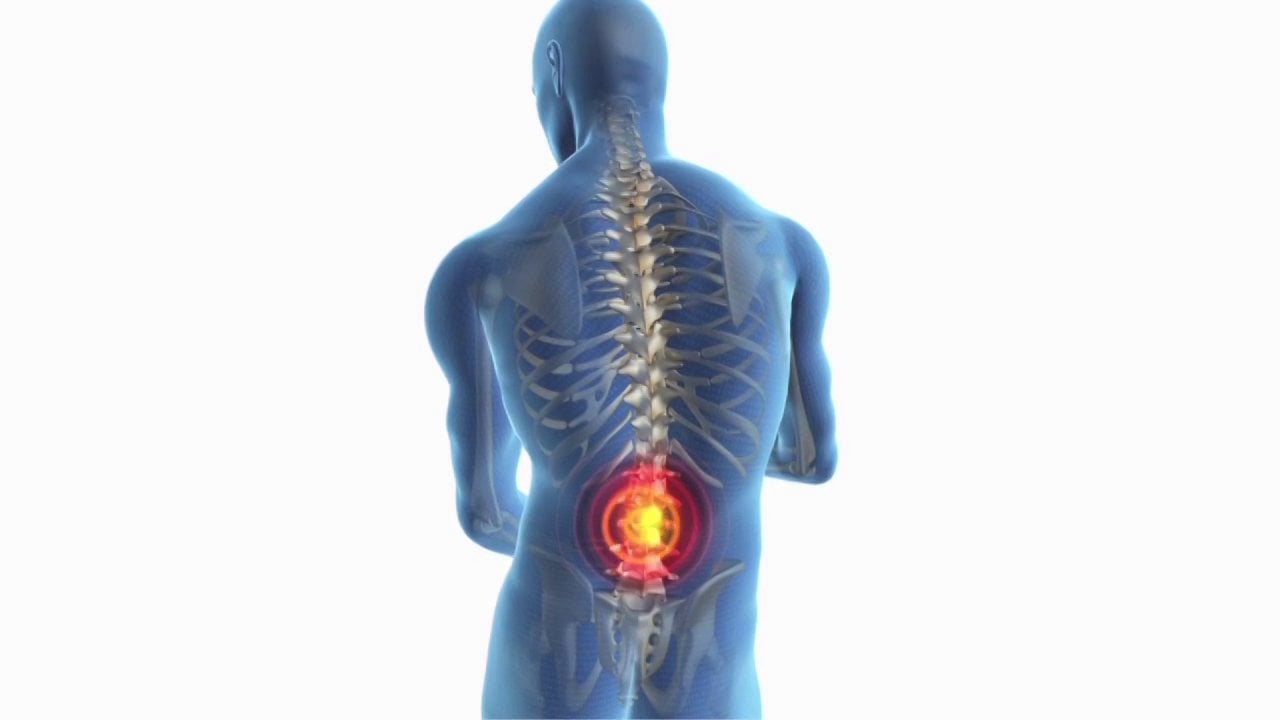 Innovations in Spinal Cord Stimulation