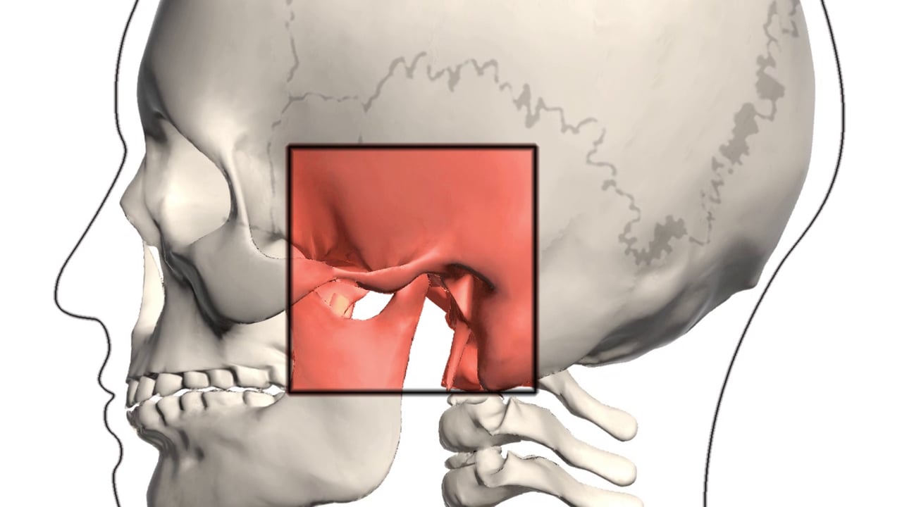 Temporomandibular Joint Disorder (TMJ)