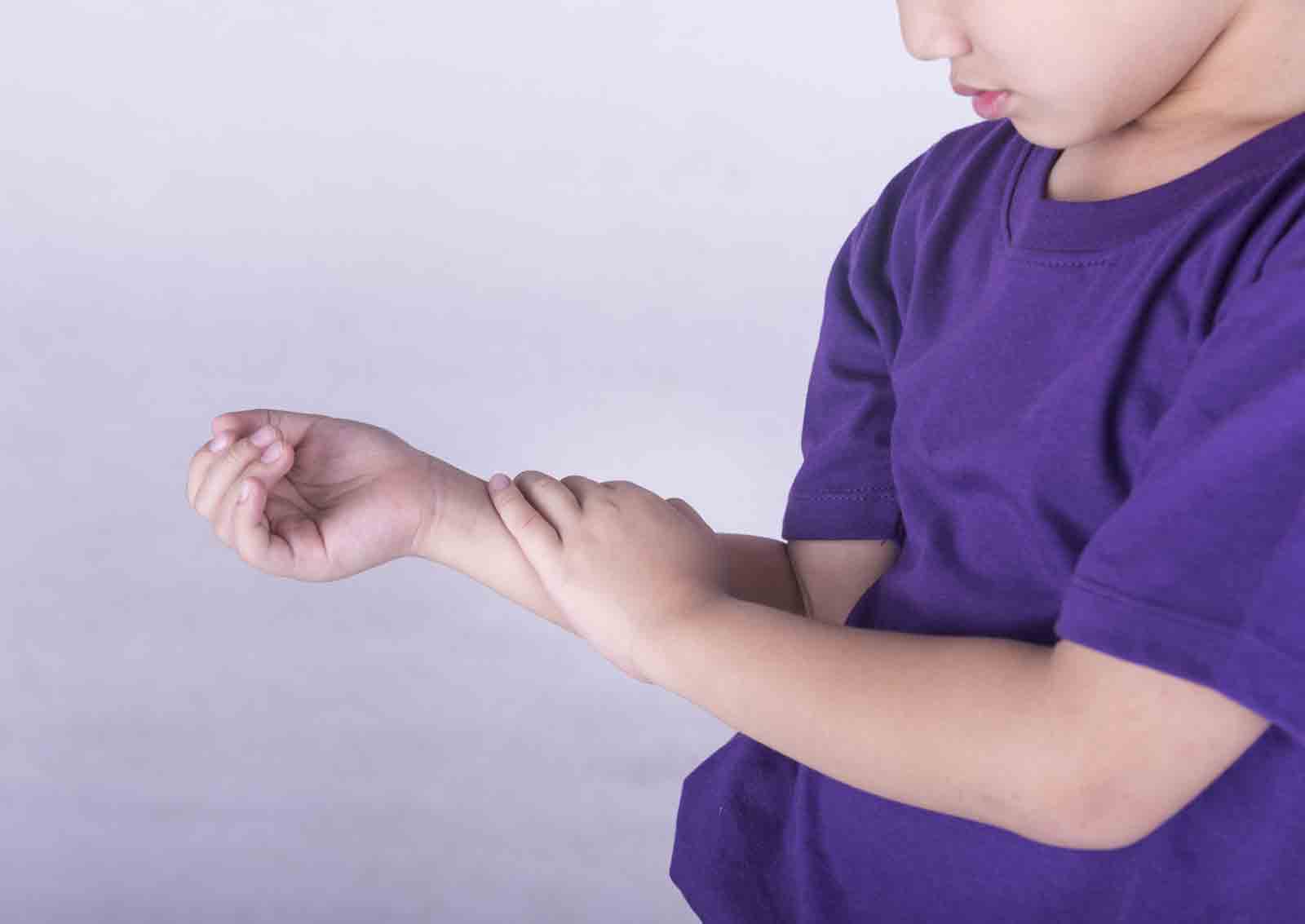 Juvenile Arthritis