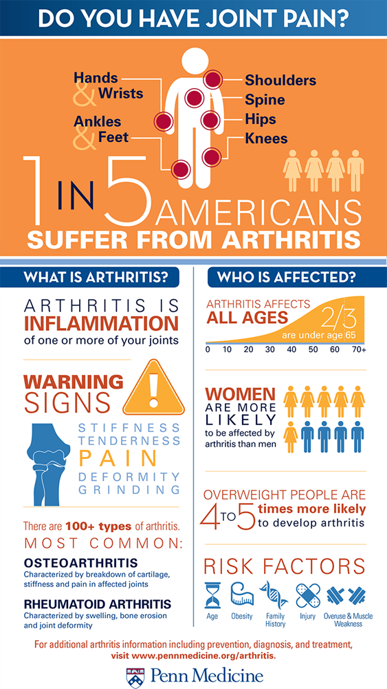 Arthritis Infographic