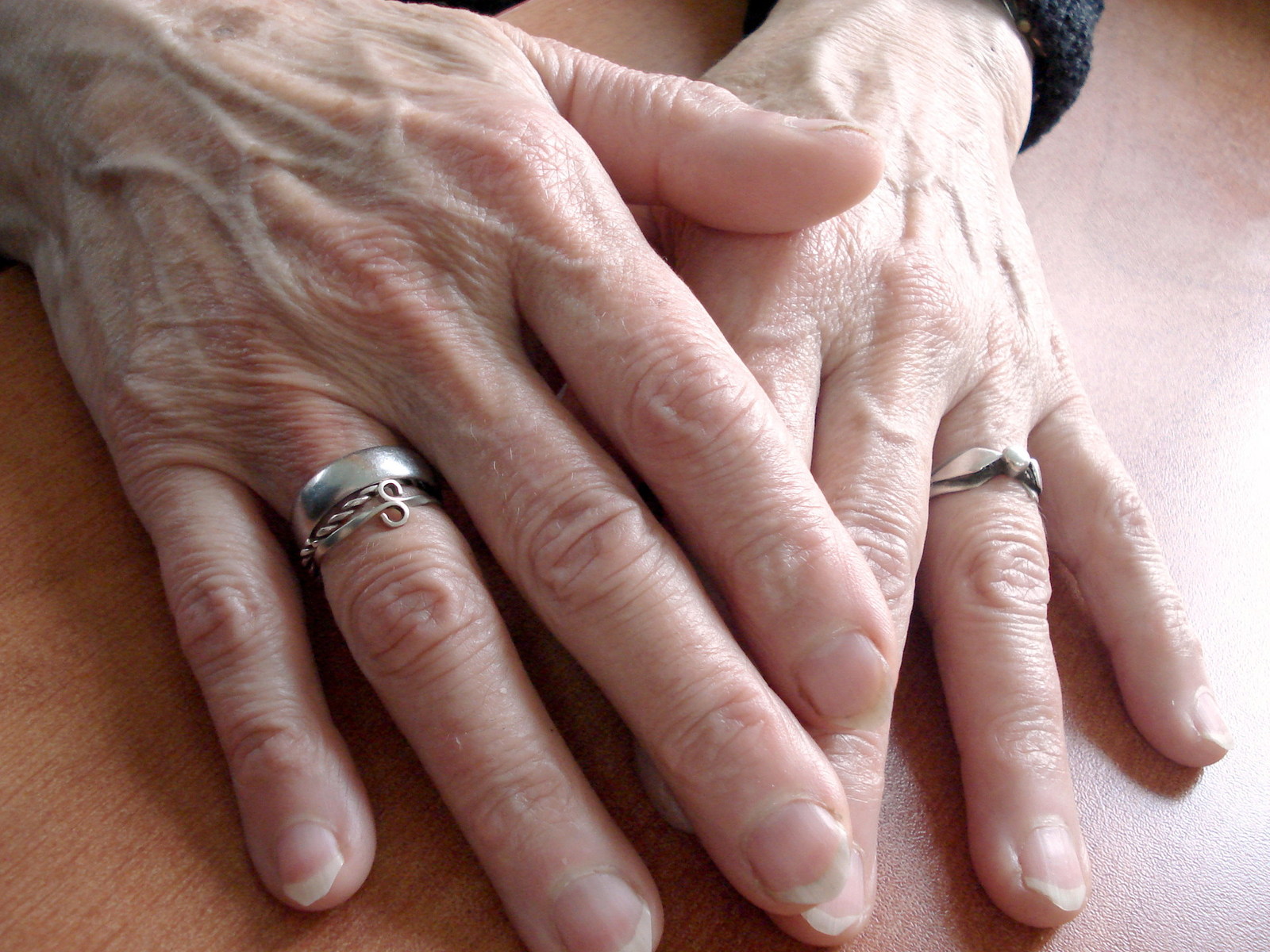 Barbara L. and Rheumatoid Arthritis – Reader Story