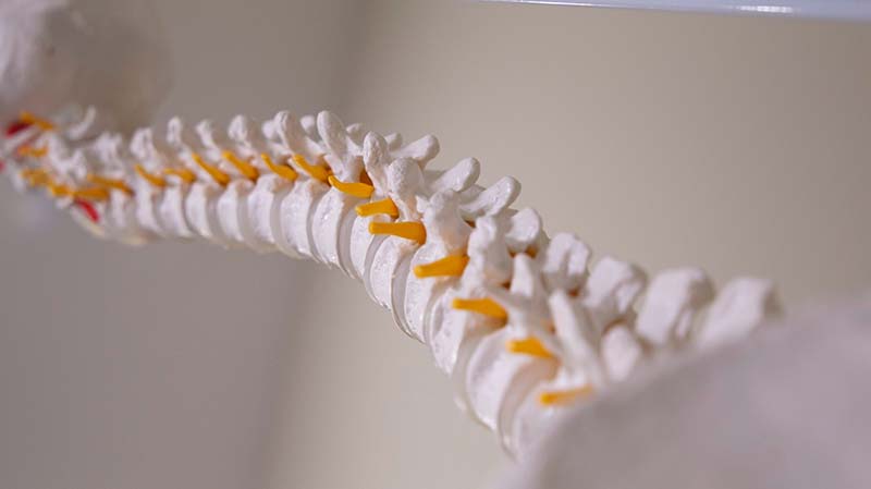 Epidural Interventions in the Management of Chronic Spinal Pain